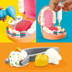 Play-Doh Drill 'n Fill Dentist Toy Ages 3+ with Cavity and Metallic Colored Modeling Compound